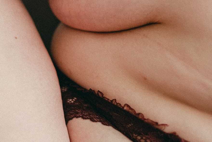ragazza curvy prima di un intervento di liposuzione