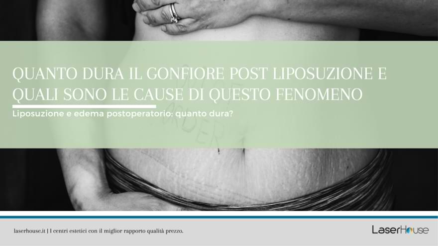 liposuzione: quanto dura il gonfiore?